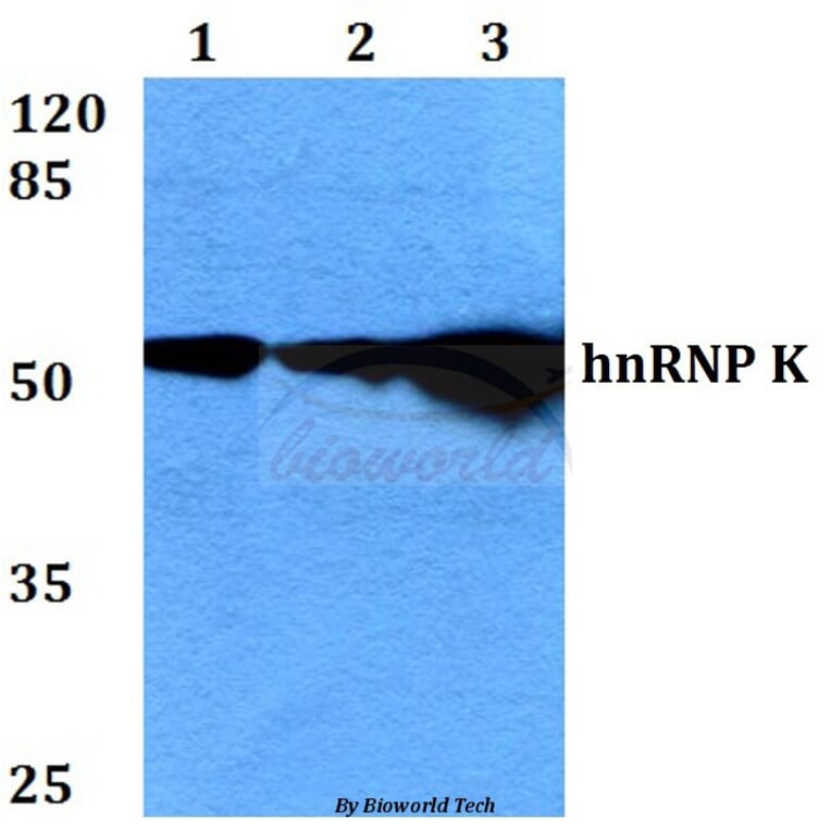 Anti-hnRNP K (Y280) Antibody from Bioworld Technology (BS2997) - Antibodies.com