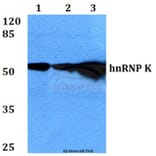 Anti-hnRNP K (Y280) Antibody from Bioworld Technology (BS2997) - Antibodies.com