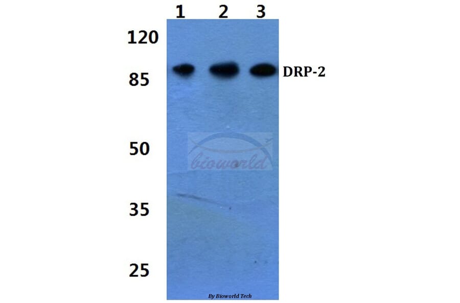 Anti-DRP-2 (P510) Antibody from Bioworld Technology (BS3005) - Antibodies.com