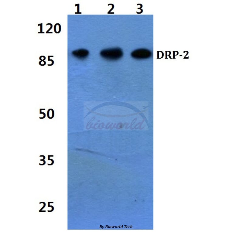 Anti-DRP-2 (P510) Antibody from Bioworld Technology (BS3005) - Antibodies.com