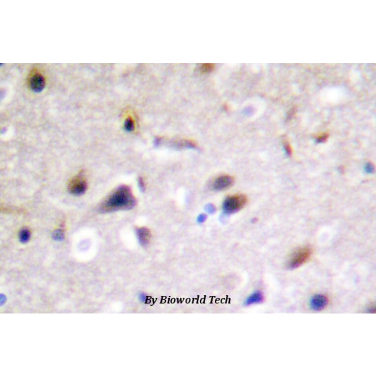 Anti-DRP-2 (P510) Antibody from Bioworld Technology (BS3005) - Antibodies.com