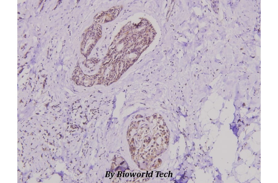 Anti-PI3K p85α/p55γ (Y463) Antibody from Bioworld Technology (BS3006) - Antibodies.com