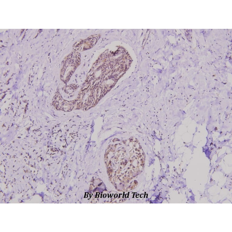 Anti-PI3K p85α/p55γ (Y463) Antibody from Bioworld Technology (BS3006) - Antibodies.com