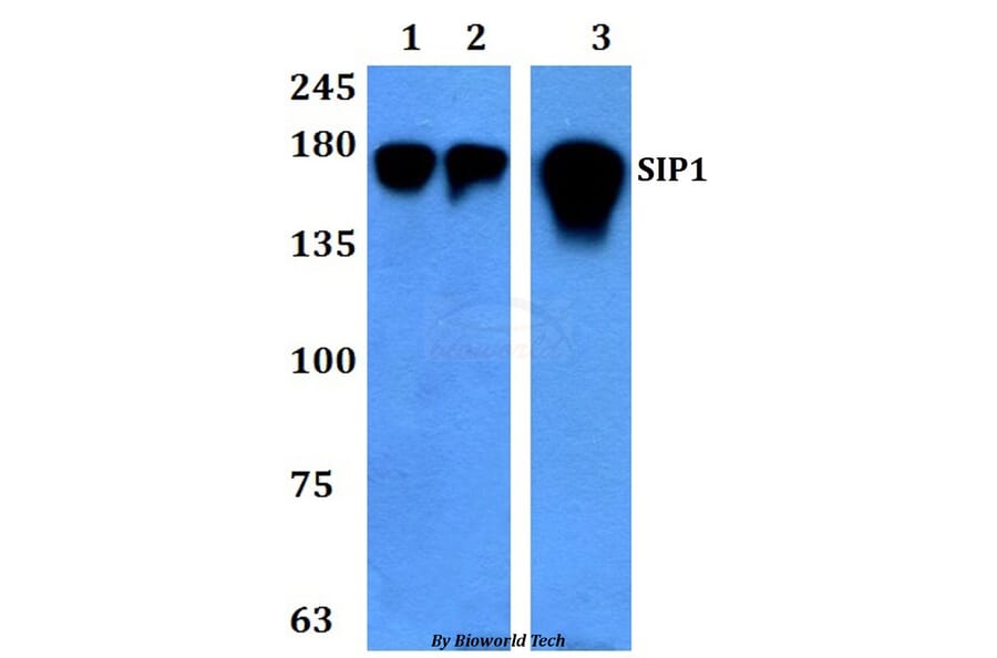 Anti-SIP1 (E101) Antibody from Bioworld Technology (BS3009) - Antibodies.com