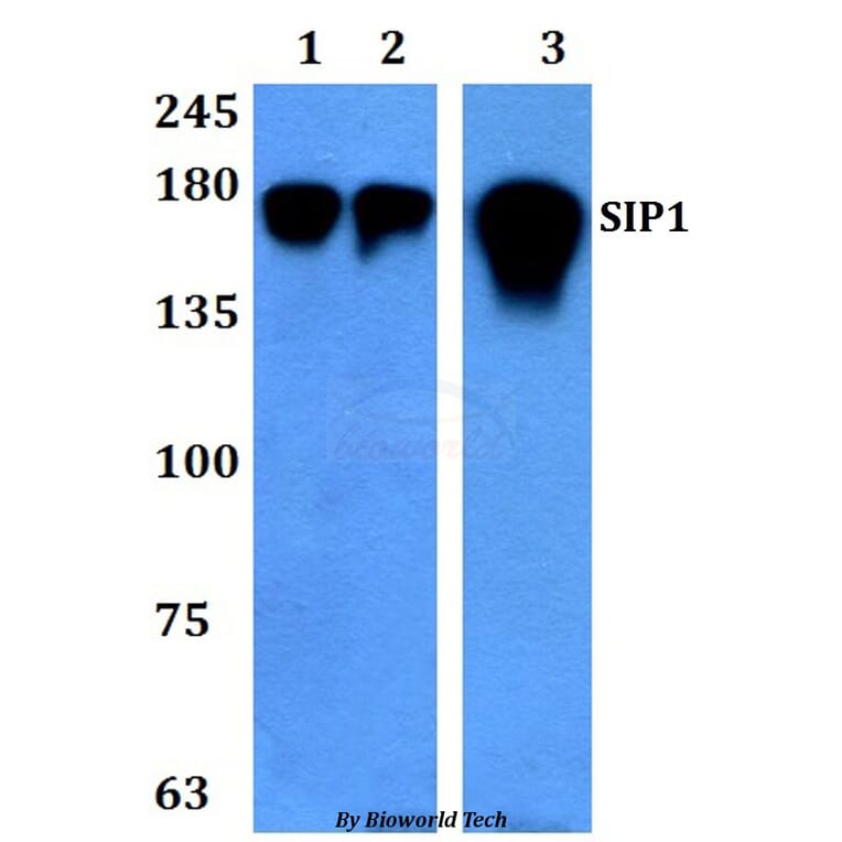 Anti-SIP1 (E101) Antibody from Bioworld Technology (BS3009) - Antibodies.com