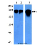 Anti-SIP1 (E101) Antibody from Bioworld Technology (BS3009) - Antibodies.com