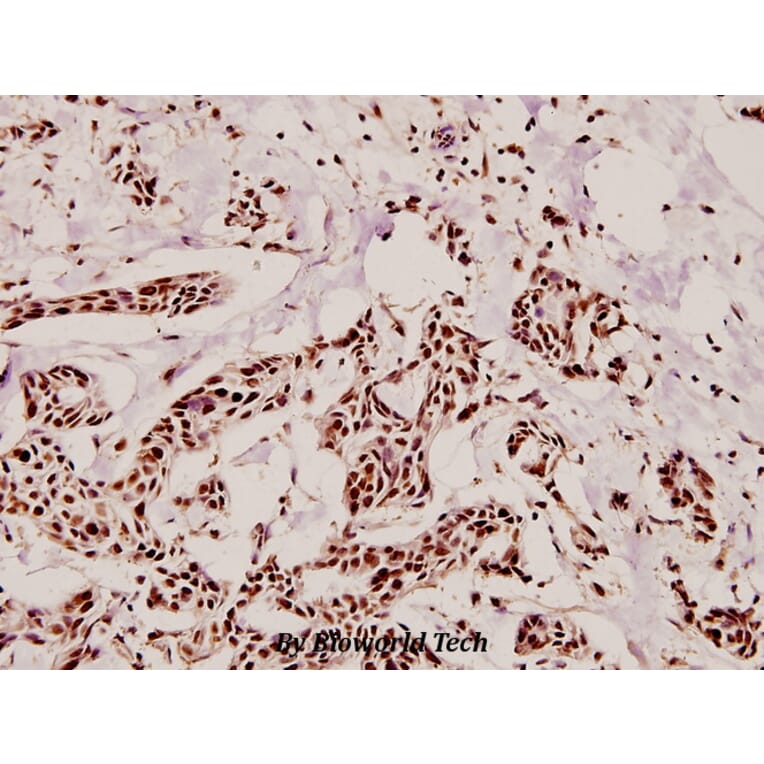 Anti-Topo IIα (Q14) Antibody from Bioworld Technology (BS3010) - Antibodies.com