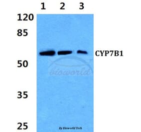 Anti-CYP7B1 (Q127) Antibody from Bioworld Technology (BS3024) - Antibodies.com