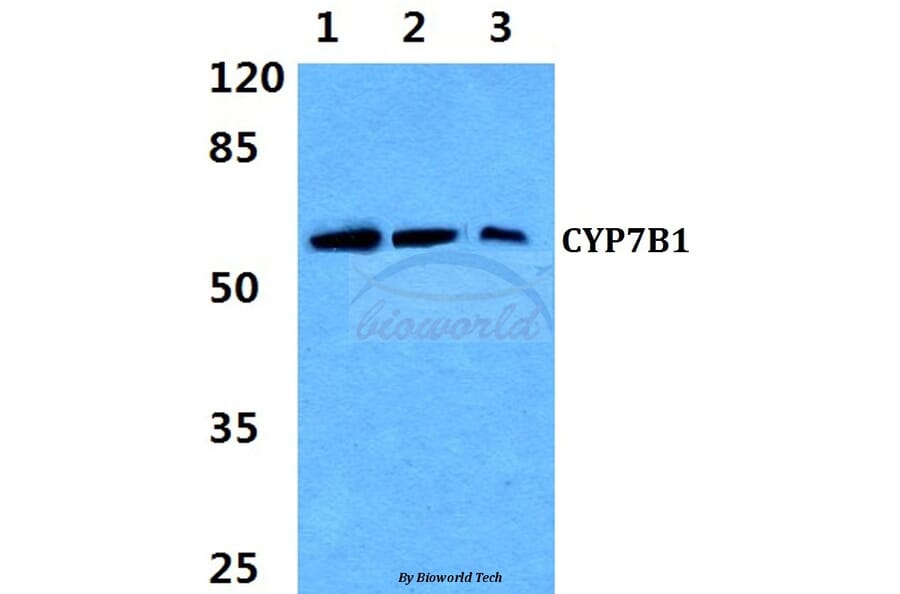 Anti-CYP7B1 (Q127) Antibody from Bioworld Technology (BS3024) - Antibodies.com