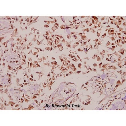 Anti-DnaJB4 (R120) Antibody from Bioworld Technology (BS3025) - Antibodies.com