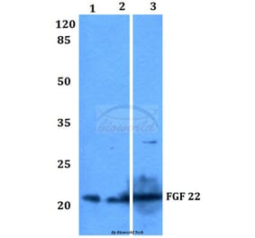 Anti-FGF 22 (A96) Antibody from Bioworld Technology (BS3026) - Antibodies.com