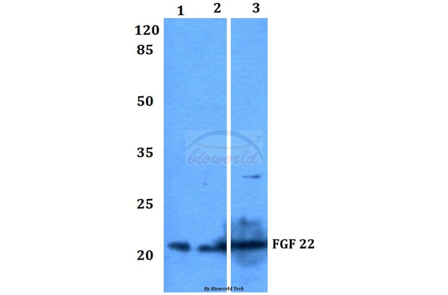 Anti-FGF 22 (A96) Antibody from Bioworld Technology (BS3026) - Antibodies.com