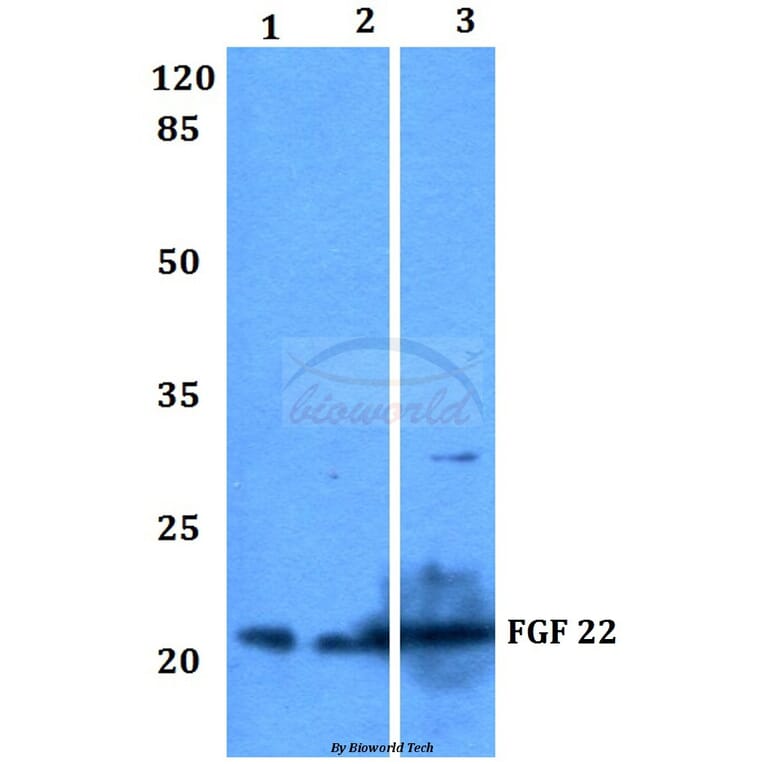 Anti-FGF 22 (A96) Antibody from Bioworld Technology (BS3026) - Antibodies.com