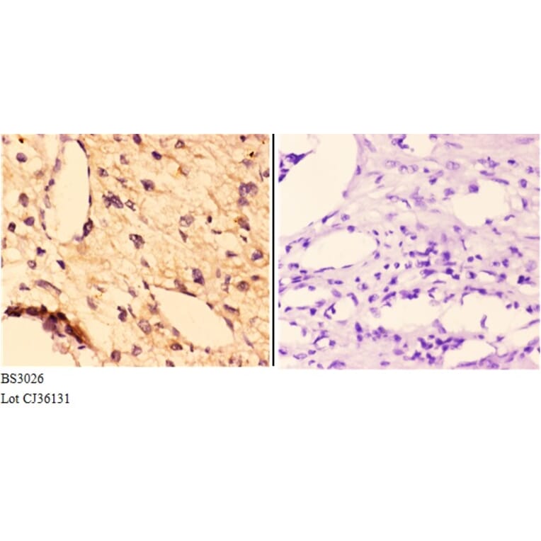 Anti-FGF 22 (A96) Antibody from Bioworld Technology (BS3026) - Antibodies.com
