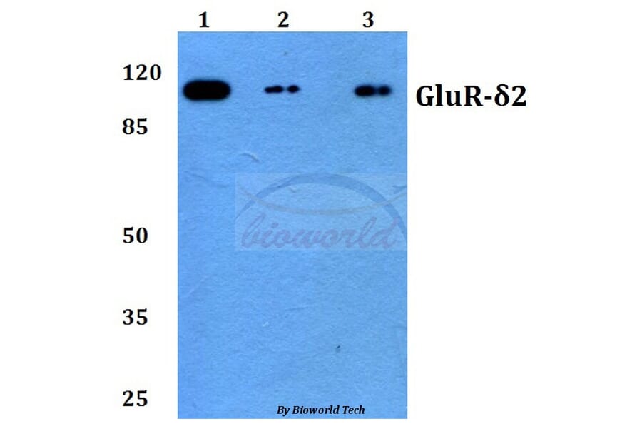 Anti-GluR-δ2 (G860) Antibody from Bioworld Technology (BS3029) - Antibodies.com