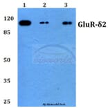Anti-GluR-δ2 (G860) Antibody from Bioworld Technology (BS3029) - Antibodies.com