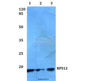 Anti-RPS12 (E125) Antibody from Bioworld Technology (BS3041) - Antibodies.com