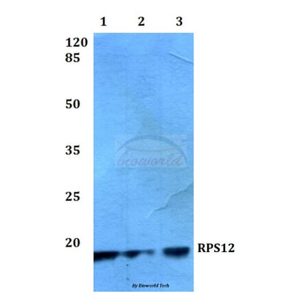 Anti-RPS12 (E125) Antibody from Bioworld Technology (BS3041) - Antibodies.com