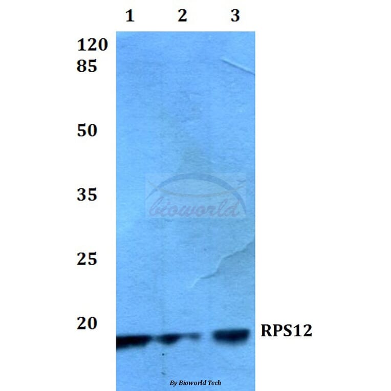 Anti-RPS12 (E125) Antibody from Bioworld Technology (BS3041) - Antibodies.com