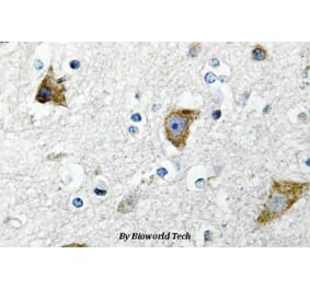 Anti-RPS20 (K67) Antibody from Bioworld Technology (BS3042) - Antibodies.com