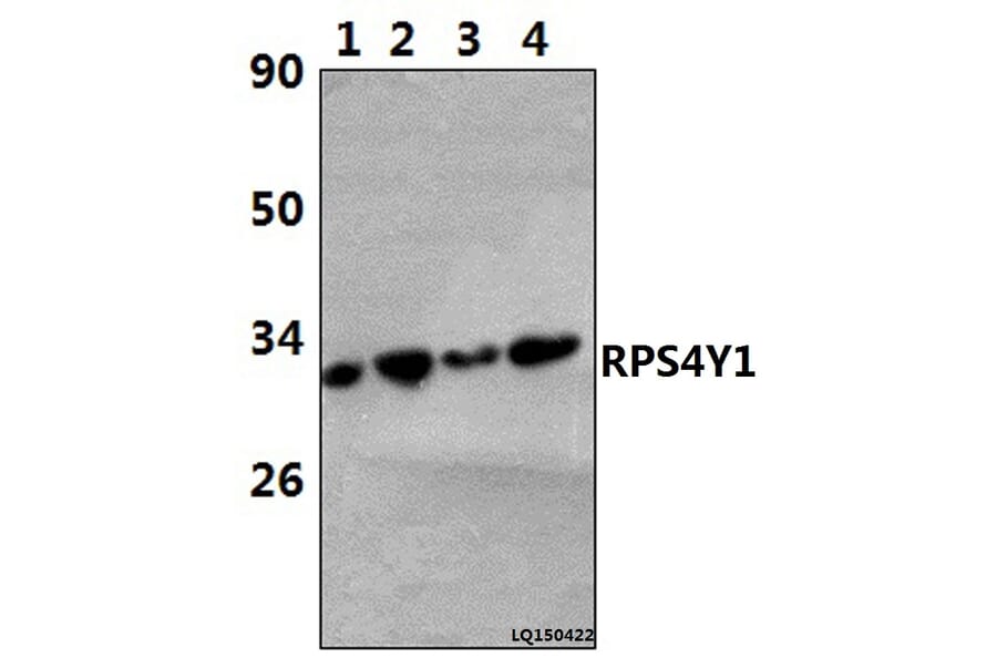 Anti-RPS4Y1 (K254) Antibody from Bioworld Technology (BS3044) - Antibodies.com
