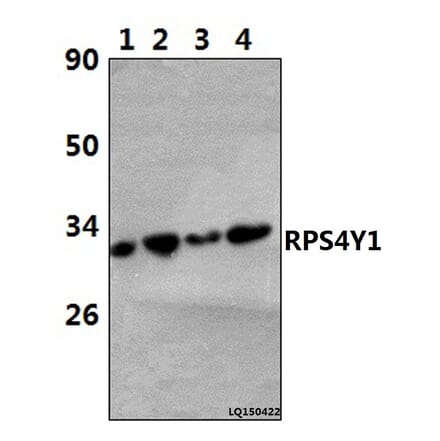 Anti-RPS4Y1 (K254) Antibody from Bioworld Technology (BS3044) - Antibodies.com