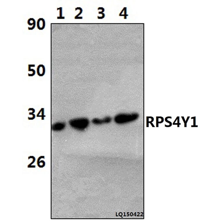 Anti-RPS4Y1 (K254) Antibody from Bioworld Technology (BS3044) - Antibodies.com