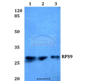 Anti-RPS9 (E73) Antibody from Bioworld Technology (BS3045) - Antibodies.com