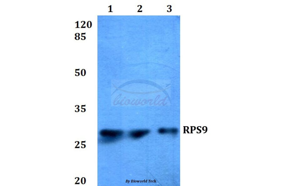 Anti-RPS9 (E73) Antibody from Bioworld Technology (BS3045) - Antibodies.com