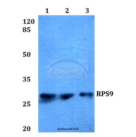 Anti-RPS9 (E73) Antibody from Bioworld Technology (BS3045) - Antibodies.com