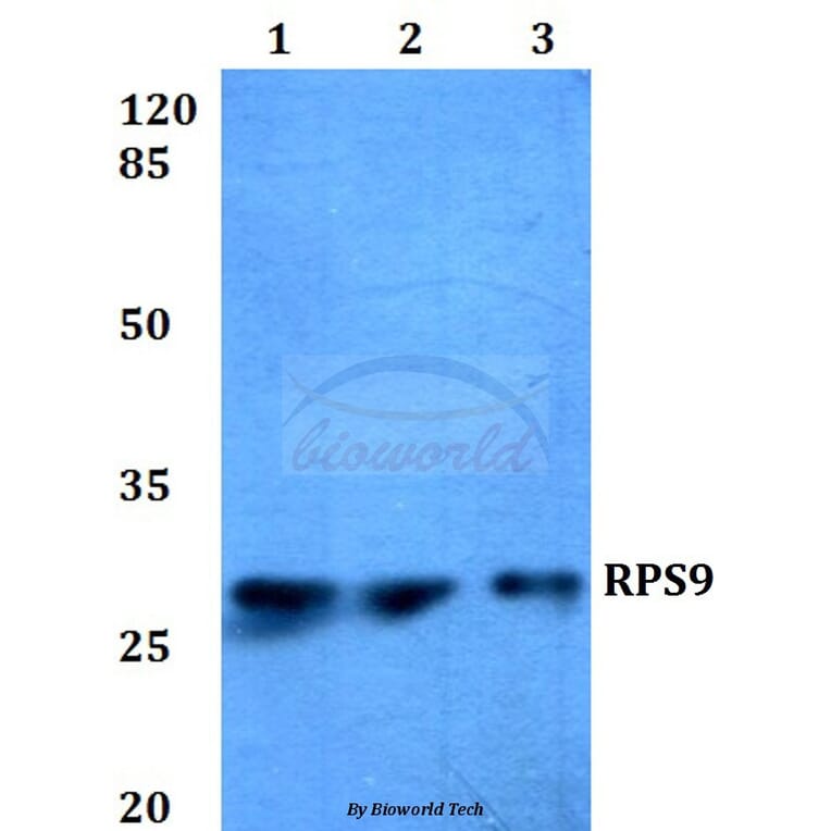 Anti-RPS9 (E73) Antibody from Bioworld Technology (BS3045) - Antibodies.com