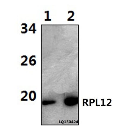 Anti-RPL12 (N103) Antibody from Bioworld Technology (BS3046) - Antibodies.com