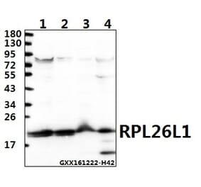 Anti-RPL26L1 (E145) Antibody from Bioworld Technology (BS3048) - Antibodies.com