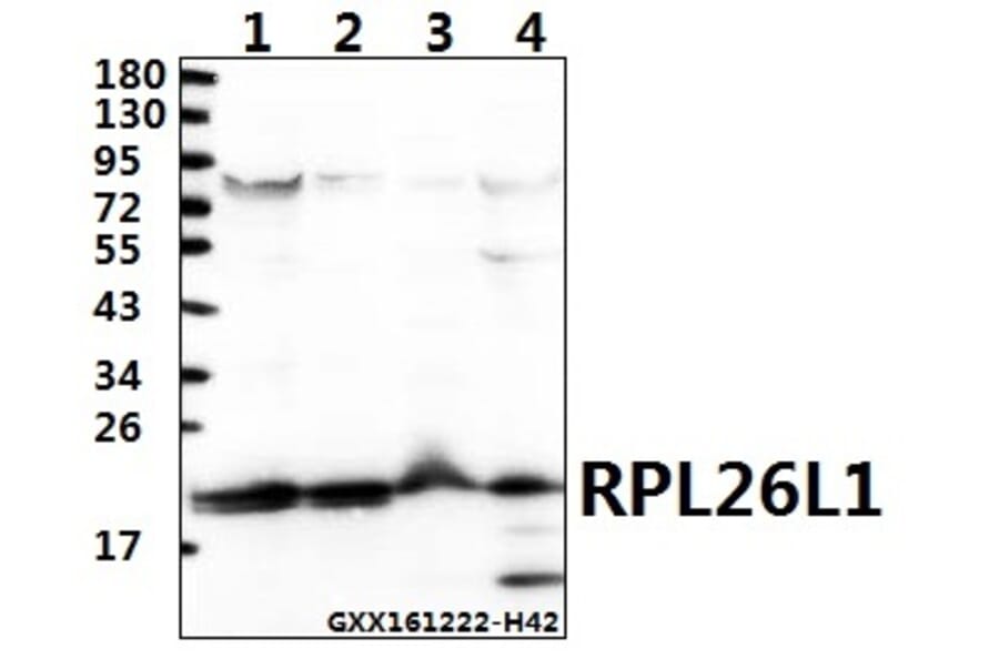 Anti-RPL26L1 (E145) Antibody from Bioworld Technology (BS3048) - Antibodies.com