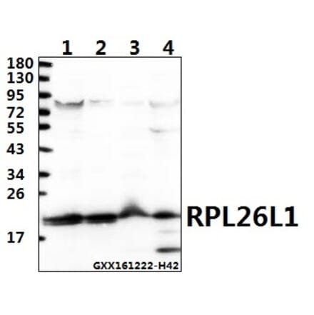 Anti-RPL26L1 (E145) Antibody from Bioworld Technology (BS3048) - Antibodies.com