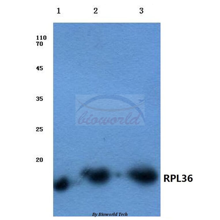 Anti-RPL36 (V93) Antibody from Bioworld Technology (BS3051) - Antibodies.com