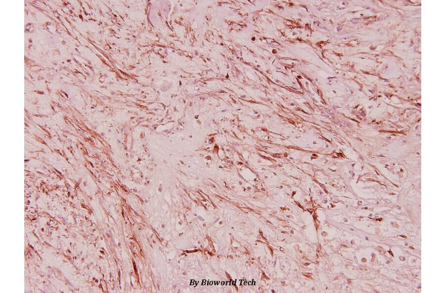 Anti-RPL36 (V93) Antibody from Bioworld Technology (BS3051) - Antibodies.com
