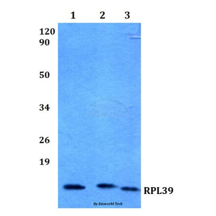 Anti-RPL39 (S39) Antibody from Bioworld Technology (BS3052) - Antibodies.com