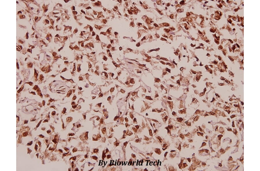 Anti-RPL39 (S39) Antibody from Bioworld Technology (BS3052) - Antibodies.com