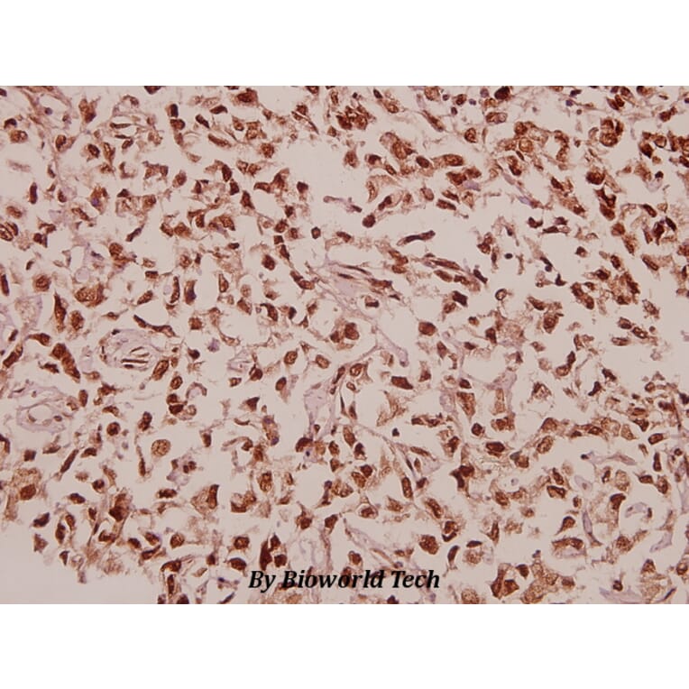 Anti-RPL39 (S39) Antibody from Bioworld Technology (BS3052) - Antibodies.com