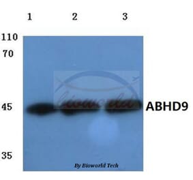 Anti-ABHD9 (D142) Antibody from Bioworld Technology (BS3058) - Antibodies.com