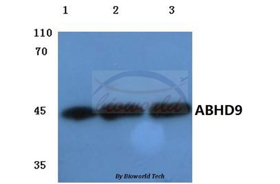 Anti-ABHD9 (D142) Antibody from Bioworld Technology (BS3058) - Antibodies.com