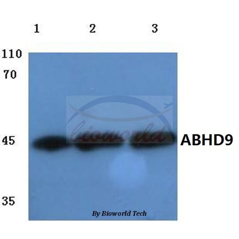 Anti-ABHD9 (D142) Antibody from Bioworld Technology (BS3058) - Antibodies.com