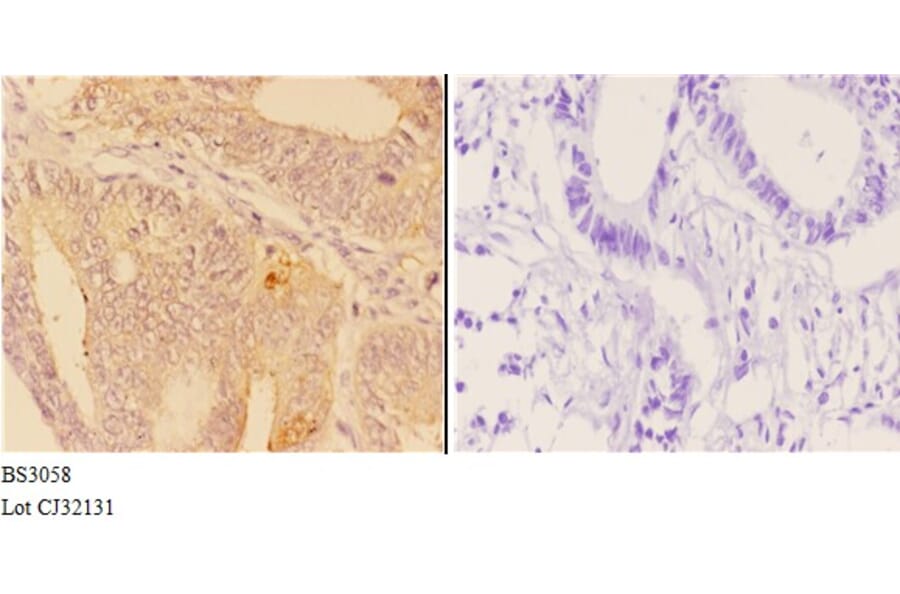 Anti-ABHD9 (D142) Antibody from Bioworld Technology (BS3058) - Antibodies.com