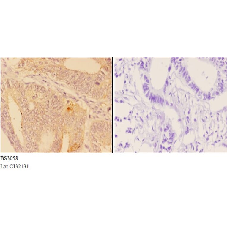 Anti-ABHD9 (D142) Antibody from Bioworld Technology (BS3058) - Antibodies.com
