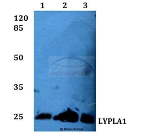 Anti-LYPLA1 (K90) Antibody from Bioworld Technology (BS3063) - Antibodies.com