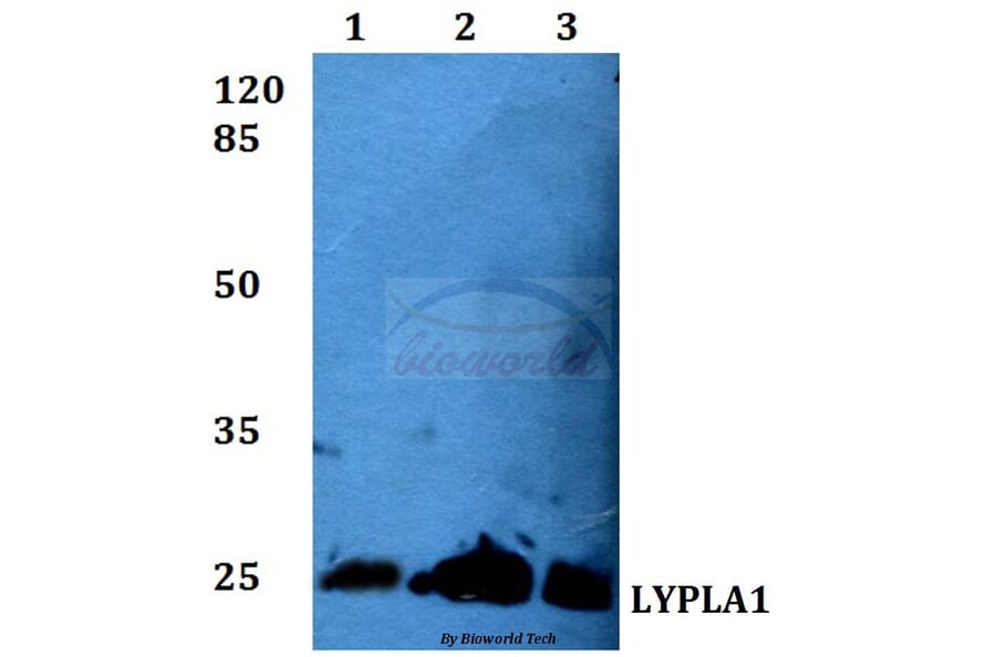 Anti-LYPLA1 (K90) Antibody from Bioworld Technology (BS3063) - Antibodies.com