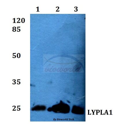 Anti-LYPLA1 (K90) Antibody from Bioworld Technology (BS3063) - Antibodies.com