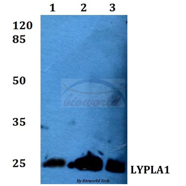 Anti-LYPLA1 (K90) Antibody from Bioworld Technology (BS3063) - Antibodies.com