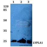 Anti-LYPLA1 (K90) Antibody from Bioworld Technology (BS3063) - Antibodies.com